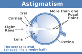 Astigmic Eye