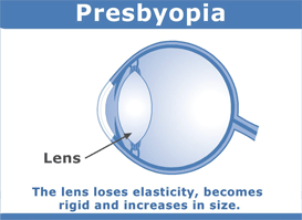 Presbyopic Eye